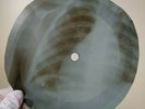 BEATLES ANNA (GO TO HIM) X-Ray USSR Record Roentgen Bones Ribs Music Vinyl