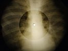 John Lennon - Woman X-RAY OF THE USSR X-RAY BONES RECORD