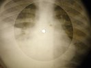 Nell Sedaka - Oh Carol X-RAY OF THE USSR X-RAY BONES RECORDING