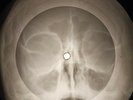 Doors - Horse Latitudes X-RAY OF THE USSR X-RAY BONES RECORD