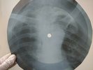 JERRY LEE LEWIS WHOLE LOTTA SHAKING X-Ray USSR Record Roentgen Ribs Music Vinyl