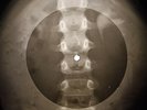 Platters - Only You X-RAY OF THE USSR X-RAY BONES RECORDING