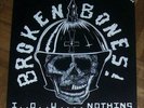 Broken Bones-