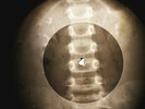 Elvis Presley - Little Sister X-RAY OF USSR X-RAY BONES RECORDING