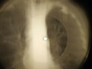 Doors - Roadhouse Blues X-RAY OF USSR X-RAY BONE RECORDING