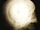 Rolling Stones - The Singer Not The Song X-RAY OF THE USSR X-RAY BONE RECORD