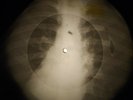 Chuck Berry - Sweet Little Sixteen  X-RAY OF USSR X-RAY BONES RECORD
