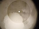Beatles - Get Back X-RAY OF THE USSR X-RAY BONES RECORD