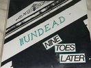 The Undead NEW Nine Toes Later 7