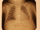 Little Richard - Long Tall Sally X-RAY OF THE USSR X-RAY BONES RECORDING
