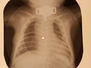 Beatles - Martha My Dear X-RAY OF THE USSR X-RAY BONES RECORDING