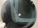 BEATLES ELEANOR RIGBY X-Ray USSR Record Roentgen Ribs Bones Music Vinyl