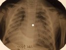 Beatles - Pepperland  X-RAY OF USSR X-RAY BONES RECORDING
