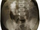 Beatles - Michelle X-RAY OF THE USSR X-RAY BONES RECORD