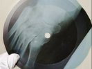 BEATLES YOU CANT DO THAT X-Ray USSR Record Roentgen Ribs Bones Music Vinyl
