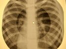 Doors - Indian summer X-RAY OF USSR X-RAY BONE RECORDING