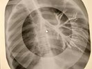 David Bowie - Bombers X-RAY OF THE USSR X-RAY BONES RECORDING