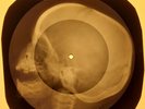 Rolling Stones - Play With Fire X-RAY OF THE USSR X-RAY BONES RECORD