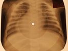 Beatles - Please Please Me X-RAY OF THE USSR X-RAY BONES RECORD