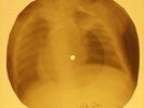 Beatles - Till There Was You X-RAY OF THE USSR X-RAY BONES RECORDING