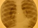 Beatles - Back In The U.S.S.R.  X-RAY OF THE USSR X-RAY BONE RECORDING