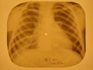 Chuck Berry - Maybellene X-RAY OF THE USSR X-RAY BONES RECORD