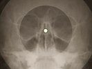 Beatles - Doctor Robert  X-RAY OF THE USSR X-RAY BONES RECORD