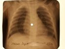Frank Ifield - Lucky Devil X-RAY OF USSR X-RAY BONES RECORD
