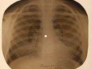 Ricky Nelson - Teenage Idol  X-RAY OF USSR X-RAY BONES RECORD
