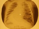 Johnny Cash - Get Rhythm  X-RAY OF THE USSR X-RAY BONES RECORD