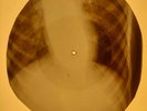 Roy Orbison - Only The Lonely X-RAY OF USSR X-RAY BONES RECORDING