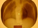 Beach Boys - You Still Believe In Me X-RAY OF THE USSR X-RAY BONE RECORDING