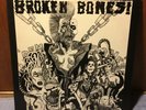 Broken Bones Dem Bones LP Orig 1984 Fallout Records kbd Discharge Gatefold