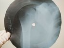 DAVID BOWIE AN OCASIONAL DREAM X-Ray USSR Record Roentgen Bones Ribs Music Vinyl