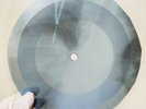 JONY MITCHEL TIN ANGEL X-Ray USSR Record Roentgen Bones Ribs Music Vinyl