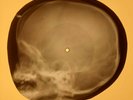 Beatles - Drive My Car  X-RAY OF THE USSR X-RAY BONES RECORDING