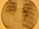 Louis Armstrong - Go Down Moses X-RAY OF THE USSR X-RAY BONES RECORD