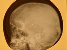 Beatles - Lovely Rita X-RAY OF THE USSR X-RAY BONES RECORD