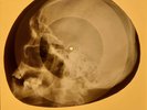 Platters - 16 Tons X-RAY OF USSR X-RAY BONES RECORDING