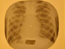 Paul Anka - Puppy Love X-RAY OF USSR X-RAY BONES RECORDING