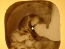Doors - Blue Sunday X-RAY OF USSR X-RAY BONE RECORDING