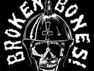 New Music Broken Bones 
