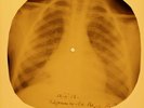 Doors - Crystal Ship  X-RAY OF USSR X-RAY BONES RECORD