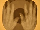 Beatles - Rock and Roll Music X-RAY OF THE USSR X-RAY BONES RECORDING