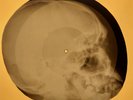 Turtles - Happy Together X-RAY OF THE USSR X-RAY BONE RECORD