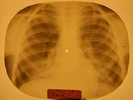 Shadows - Apache X-RAY OF THE USSR X-RAY BONES RECORDING