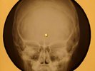 Janis Joplin - Mercedes Benz X-RAY OF USSR X-RAY BONES RECORDING