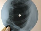 BOB DYLAN CORRINA CORRINA X-Ray USSR Record Roentgen Bones Ribs Music Vinyl