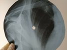 BOB DYLAN MY BACK PAGES X-Ray USSR Record Roentgen Bones Ribs Music Vinyl