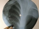 JONY RIVERS BABY I NEED YOUR X-Ray USSR Record Roentgen Bones Ribs Music Vinyl